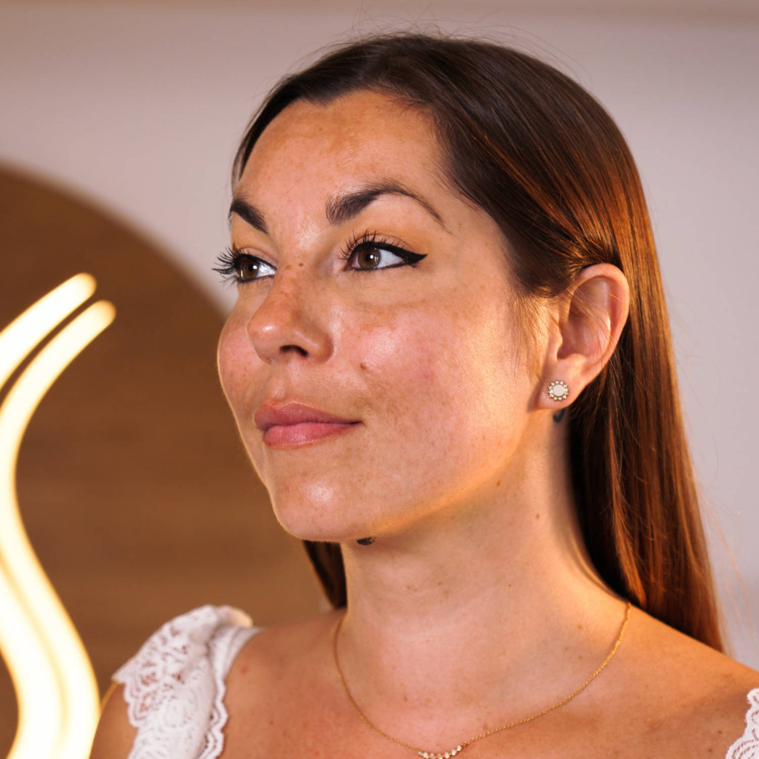Portrait de notre modèle Alice après injections d'acide hyaluronique pour les pommettes et la ligne de l'ovale