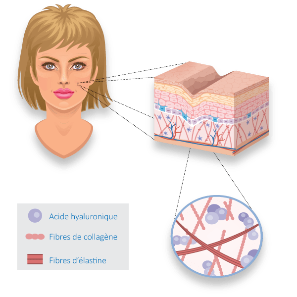 Illustration d'une peau de visage intermédiaire et des soins de médecine esthétique à Lille Villeneuve d'Ascq du docteur Sar