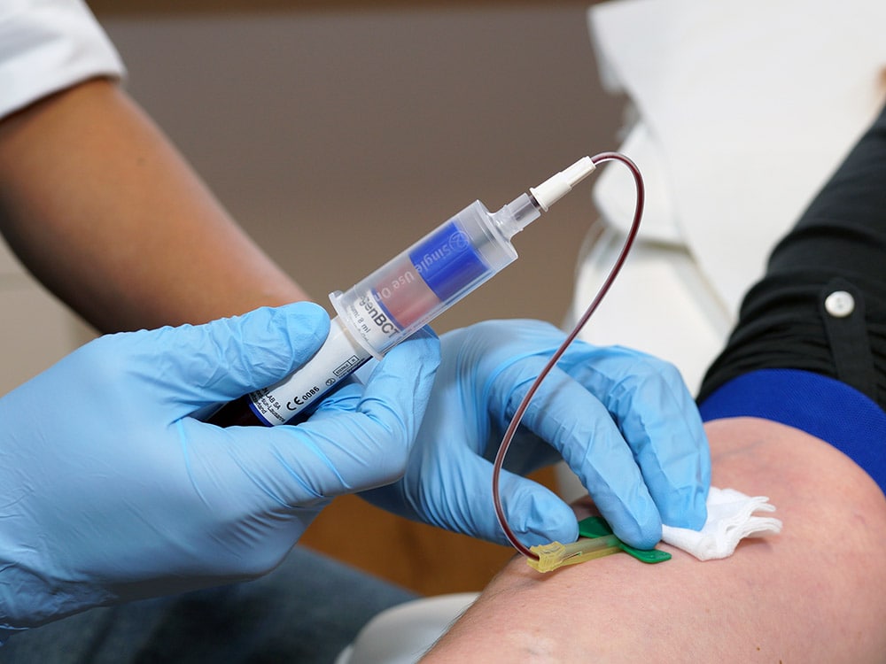 Prise de sang pour la réalisation d'injection de PRP à Lille Villeneuve d'Ascq